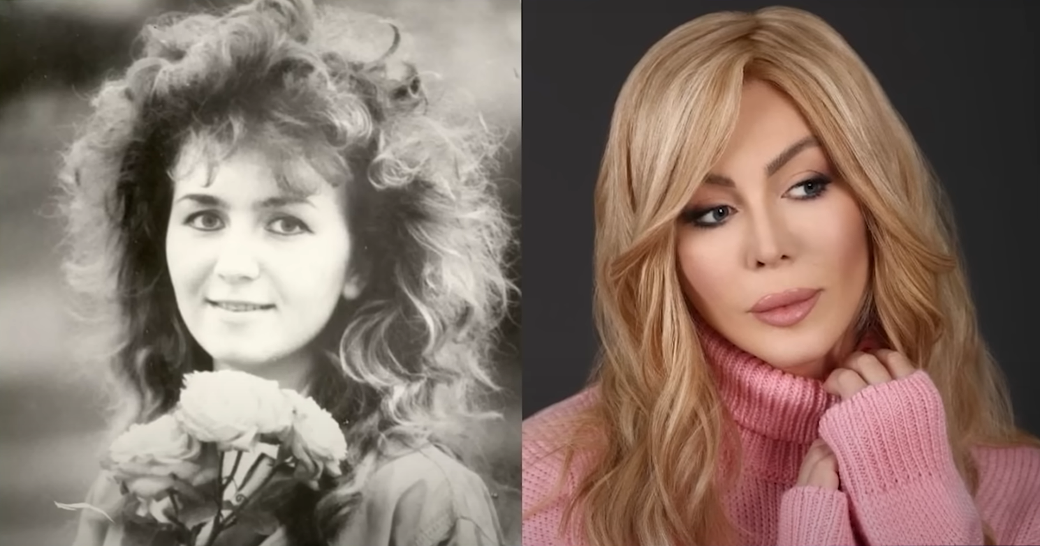 Ирине Билык — 56. Как пластические операции изменили внешность певицы (фото)